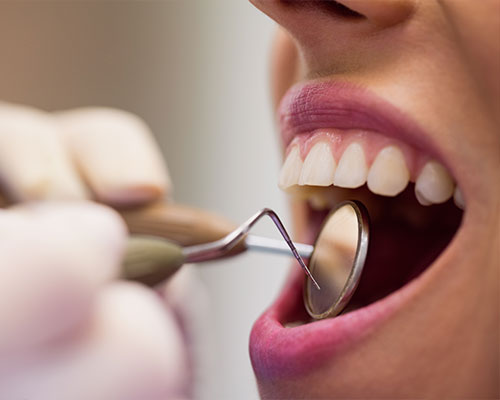 servicios-dentales-periodoncia