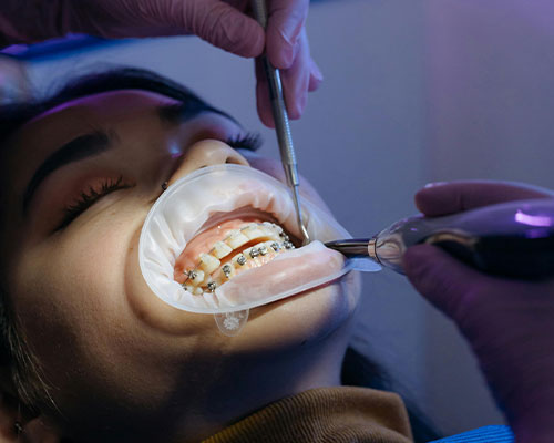 servicios-dentales-ortodoncia-y-brackets